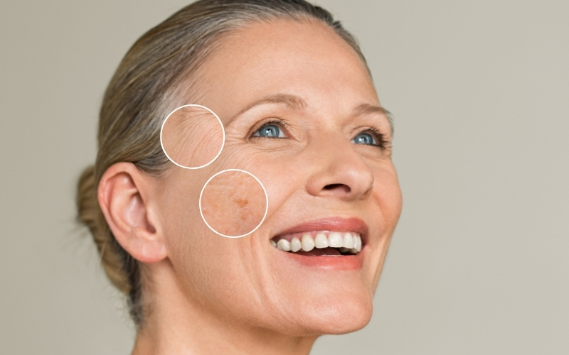 Sonnenschäden vorbeugen & lindern – mit professioneller Hautpflege