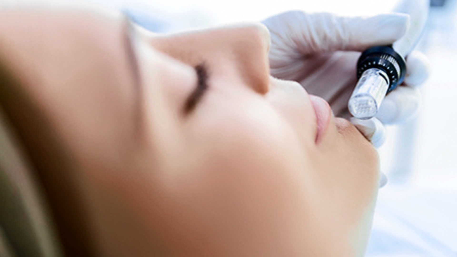 Ultra Precision Needling von JANSSEN COSMETICS